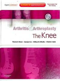 Image of Arthritis and Arthroplasty The Knee
